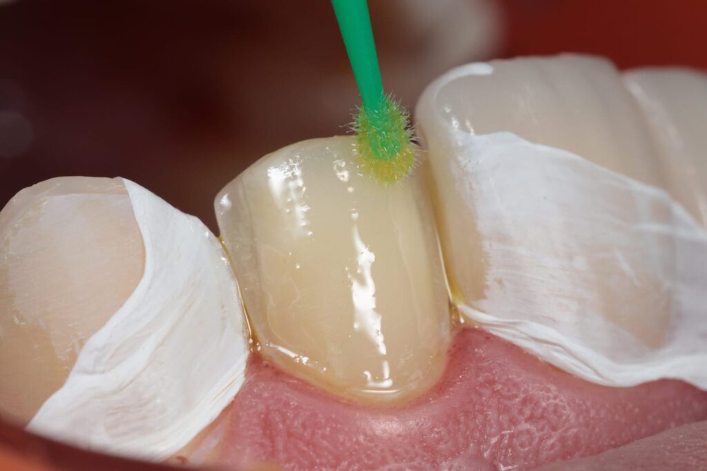 dentadura en dentista ciudad de méxico